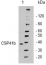 CSP41b | ribosome associated endonuclease (CRB)